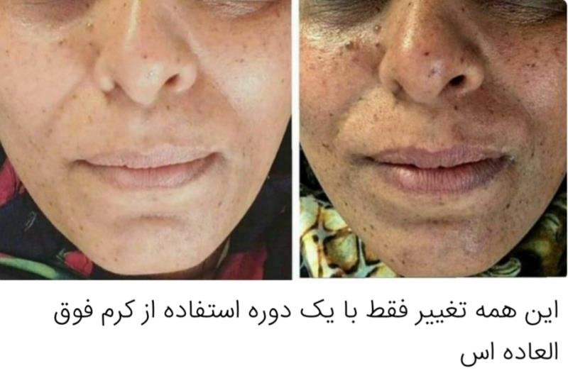 کرم وصابون ضدلک وروشن کننده معجزه شب آسناد