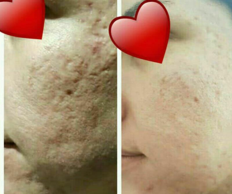 کرم وصابون ضدلک وروشن کننده معجزه شب آسناد