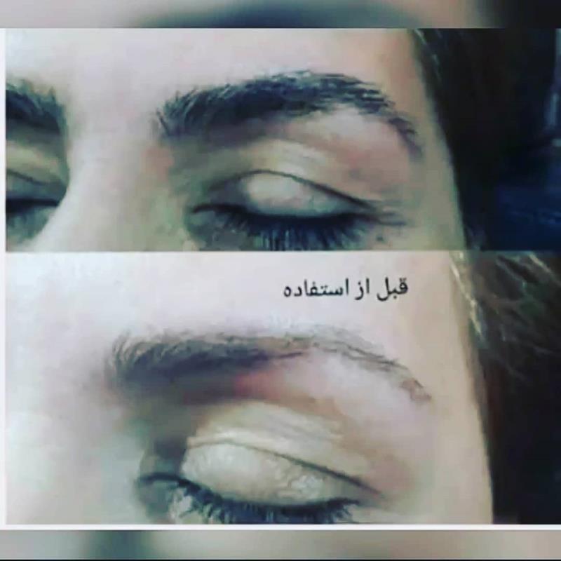 تونیک تقویت کننده وپرپشت کننده مژه وابرو