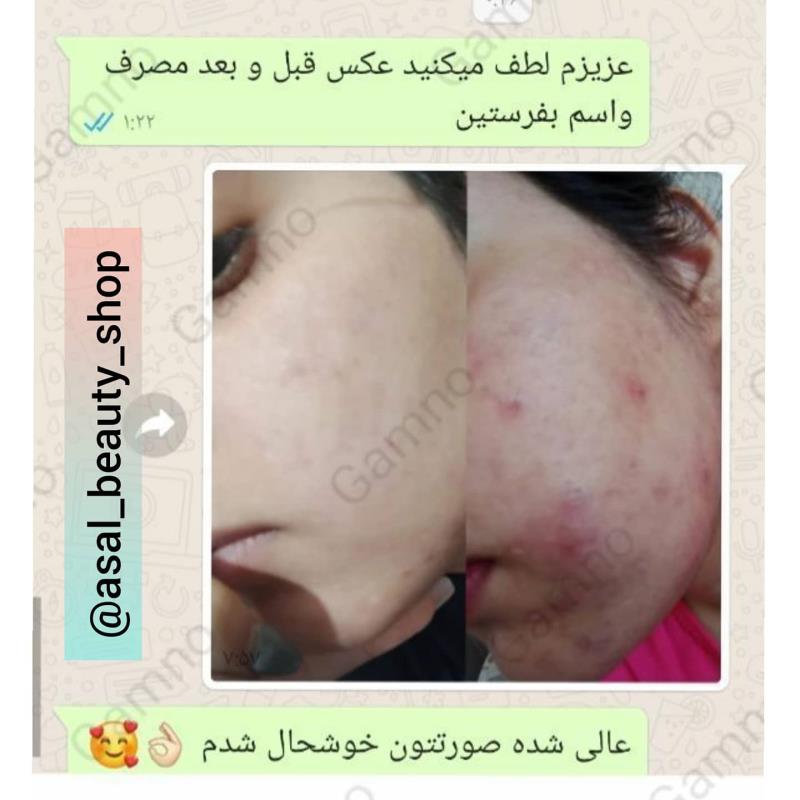 کرم ضد لک و ضد جوش وایت رز گامنو