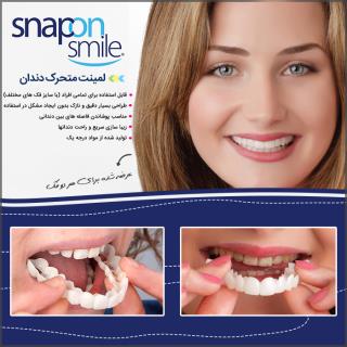 لمینت متحرک دندان Snap On Smile