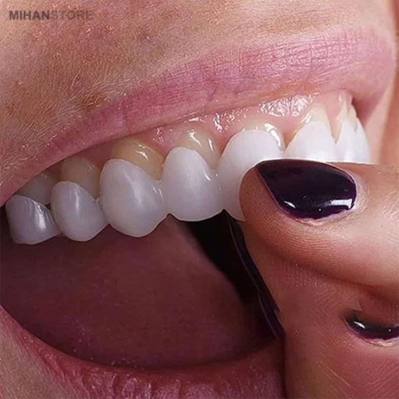لمینت متحرک دندان Snap On Smile