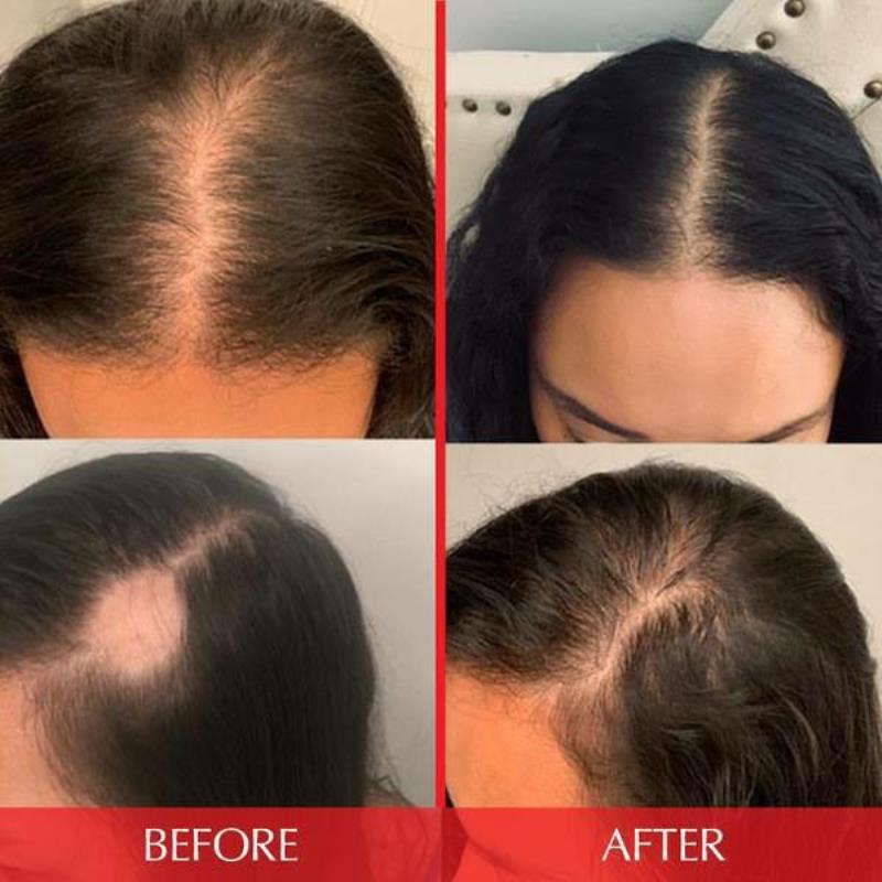 کپسول هیرتامین | تقویت کننده و ضد ریزش؛ هیرتامین اصل| Hairtamin