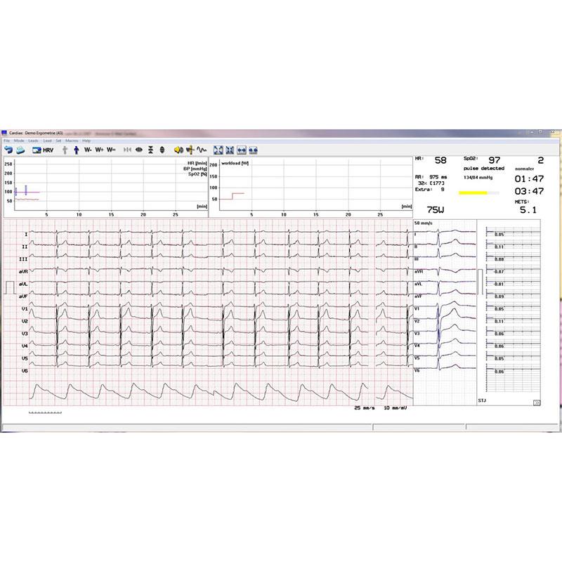 دستگاه نوار قلب ۱۲ کاناله Cardiax