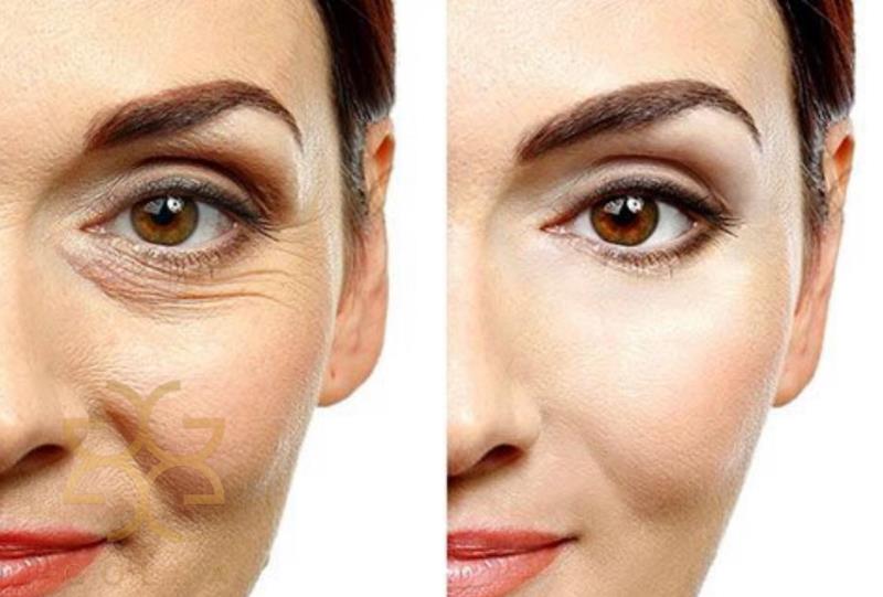 سرم دورچشم ضد تیرگی و پف کافئین اوردینری اصل حجم 30 میل