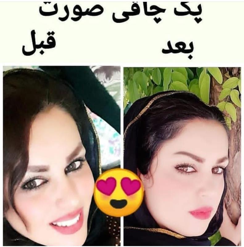 كرم پف صورت وگونه گذار سوماتلين