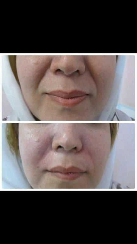 کرم جوانسازوليف كننده شب لازان مدل Q10 حجم 50 میلیلیتر