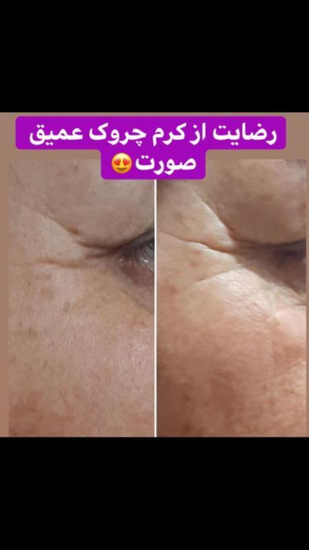 کرم جوانسازوليف كننده شب لازان مدل Q10 حجم 50 میلیلیتر