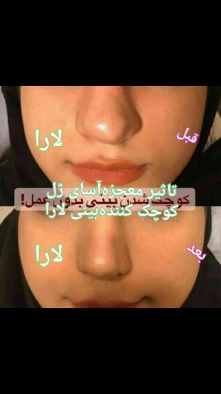 ژل کوچک کننده بینی120میلی گرم