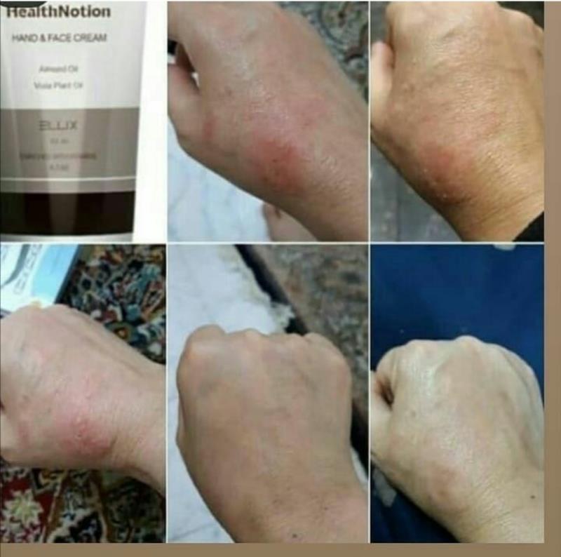 کرم نرم کننده ی گیاهی دست و صورت ۵۰ میل هلث نوشن( الیکس)